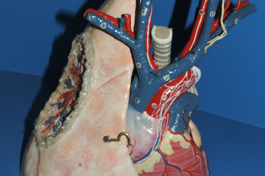 Coeur et poumon - ©musee anatomie