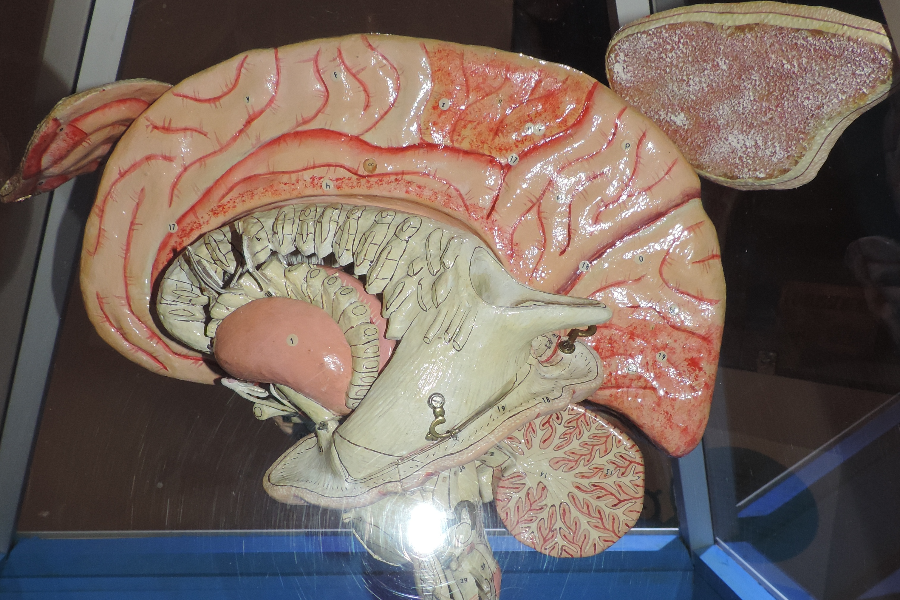Cerveau Humain - ©musee anatomie